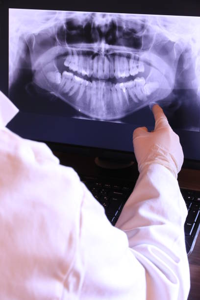 Best Emergency Dentist for Knocked-Out Tooth in Reynoldsburg, OH